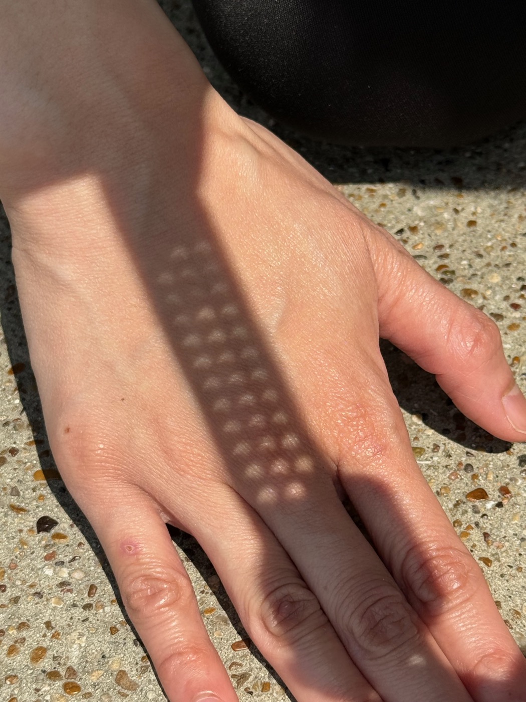 A picture of the shadow of my watch strap, which has many holes in it, being cast on my wife's hand. The light shining through the holes is slightly crescent-shaped.